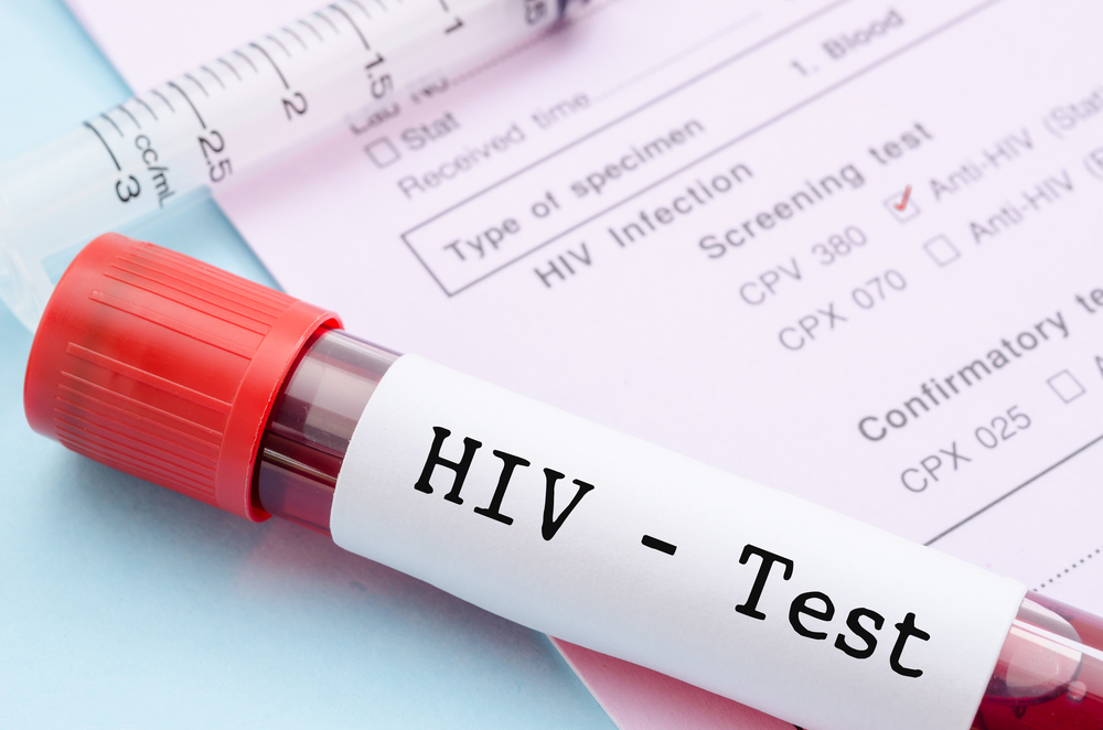 remissão do HIV